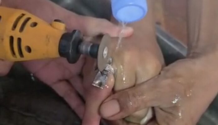 Cincin Terjebak di Jari, Tim DAMKARMAT Kendari Sigap Evakuasi