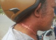 Diduga Terlilit Kabel Internet Menjuntai, Warga Kendari Alami Luka di Leher