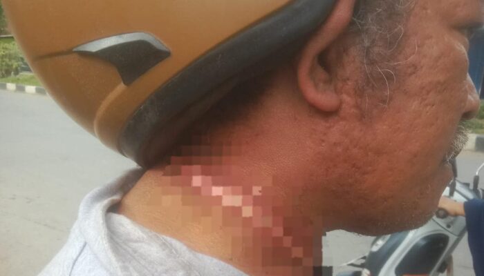 Diduga Terlilit Kabel Internet Menjuntai, Warga Kendari Alami Luka di Leher