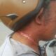 Diduga Terlilit Kabel Internet Menjuntai, Warga Kendari Alami Luka di Leher